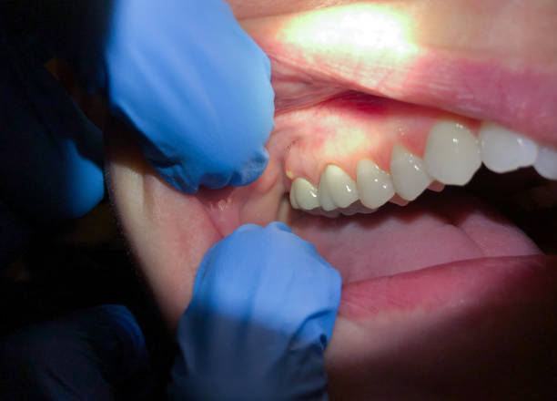 Best Cracked Tooth Emergency Dentist  in Hubbard, TX
