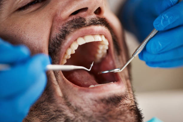 Best Cracked Tooth Emergency Dentist  in Hubbard, TX